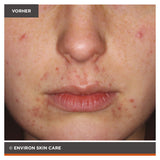 ENVIRON - Focus Care Clarity+ Botanical Infused Sebu-Tone Clarifier - Toner - Environ Skin Care - ZEITWUNDER Onlineshop - Kosmetik online kaufen